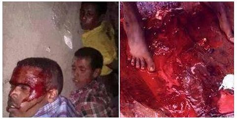 Students killed by federal police. የዩኒቨርሲቲ ተማሪዎች ተገደሉ፣ ተደበደቡ